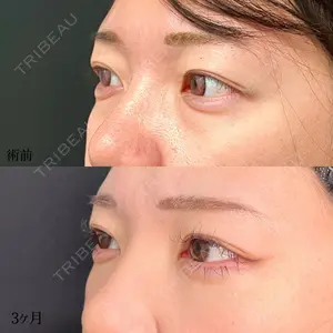 90 days after image