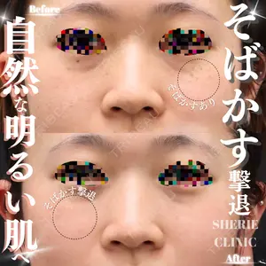 before image