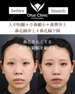 90 days after image