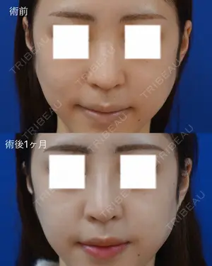 before image