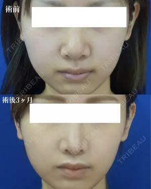 before image