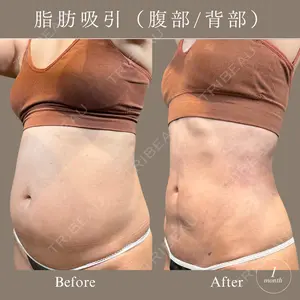 30 days after image