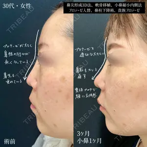 90 days after image