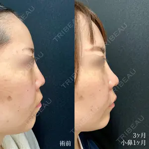 90 days after image