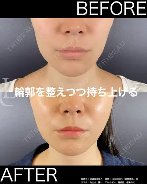 before image