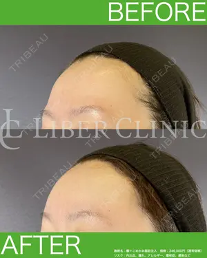 before image