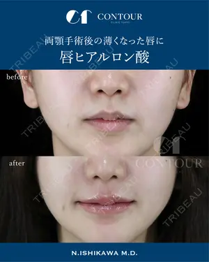 before image