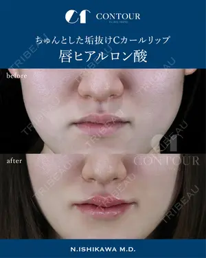 0 days after image