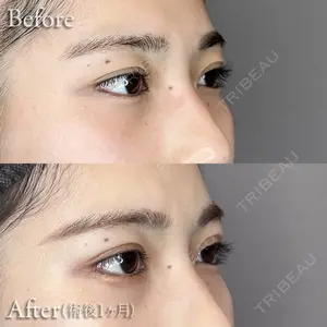 before image