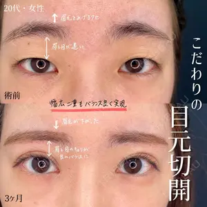 90 days after image