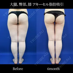 180 days after image