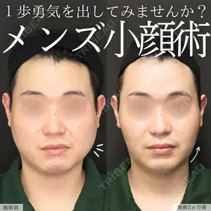 90 days after image