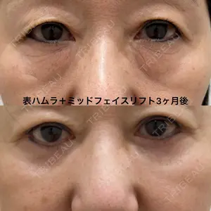 90 days after image