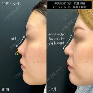 90 days after image