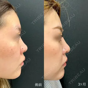 90 days after image