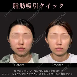 60 days after image