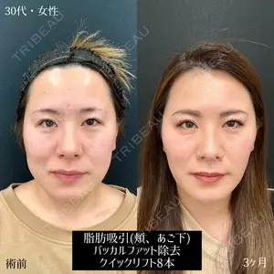 90 days after image