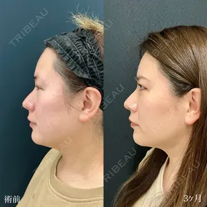 90 days after image