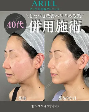 90 days after image