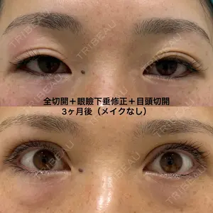 90 days after image