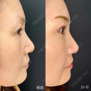 90 days after image