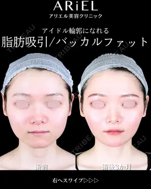 90 days after image