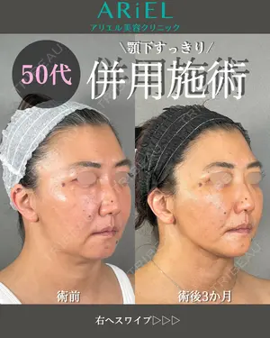 90 days after image