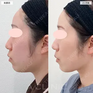 60 days after image