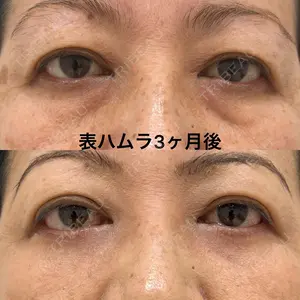 90 days after image