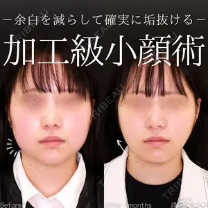 60 days after image