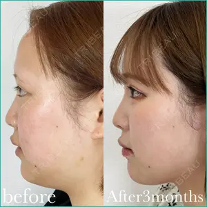 90 days after image