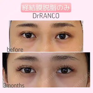 90 days after image