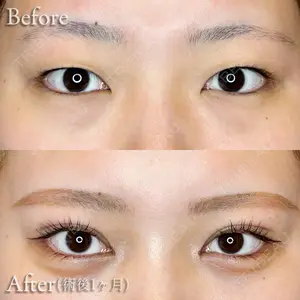 before image