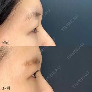 90 days after image