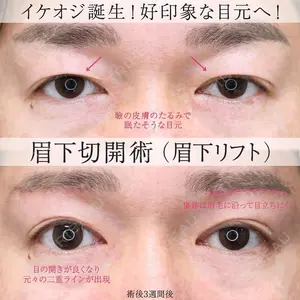 before image