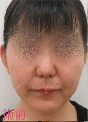 before image