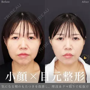 90 days after image