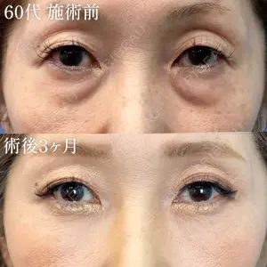 90 days after image