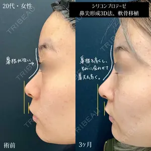 90 days after image