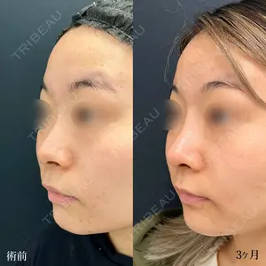 90 days after image