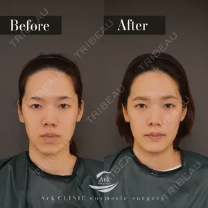 90 days after image