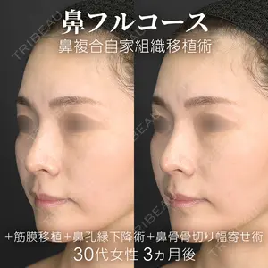 90 days after image