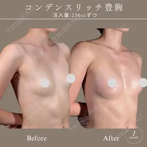 30 days after image