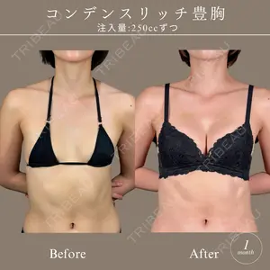 28 days after image