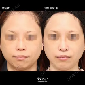 180 days after image