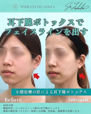 150 days after image