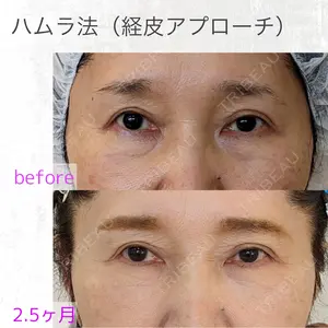 70 days after image