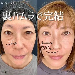 90 days after image