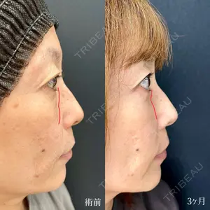 90 days after image