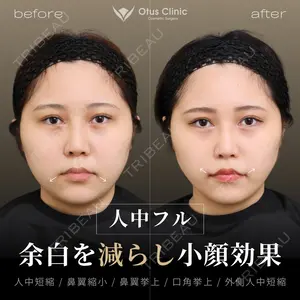 90 days after image